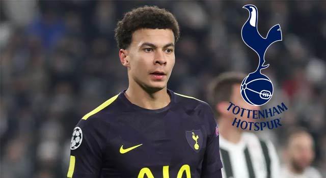 เดเล่ อัลลี